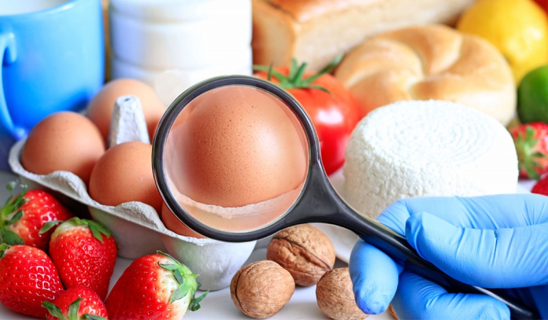 سیستم مدیریت امنیت مواد غذایی